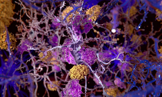 What Are Microglia And What Do They Do In The Brain?