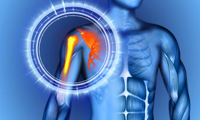 Shoulder hypertrophy